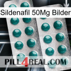 Sildenafil 50Mg Images dapoxetine2
